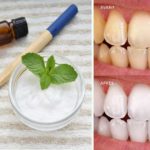 Fabriquer son dentifrice naturel fait maison